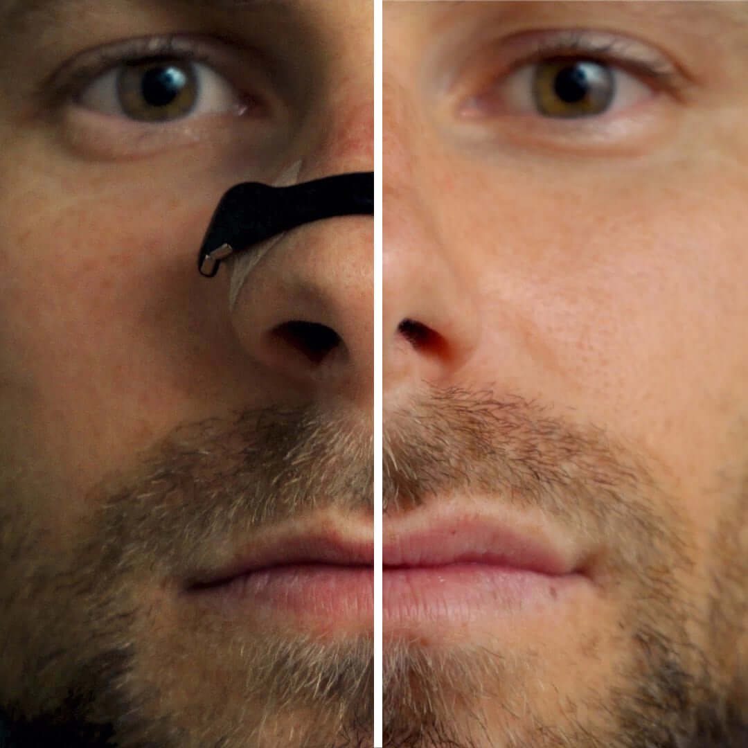 Airo Magnetic Nasal Band Kit - The New Standard in Breathing
